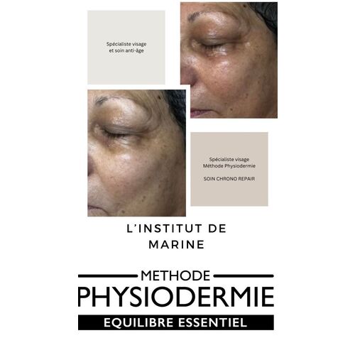 Soin visage Physiodermie